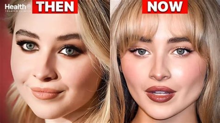 Sabrina Carpenter Reveals Lip Filler Transformation: Before And After Photos