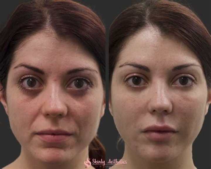 See The Before And After Faces