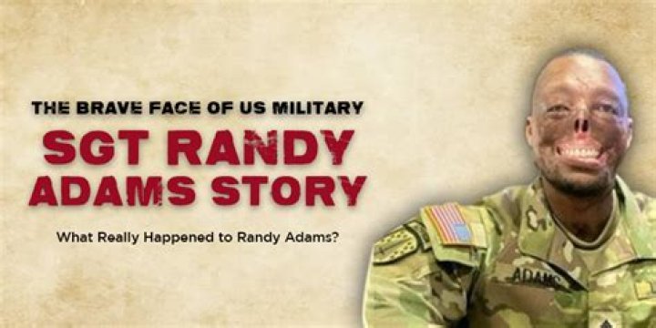 The Aftermath Of Randy Adams' Devastating Facial Accident