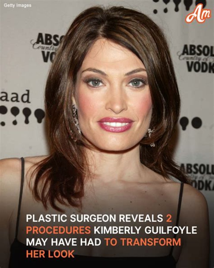 The Fascinating Age Of Kimberly Guilfoyle: Unveiled