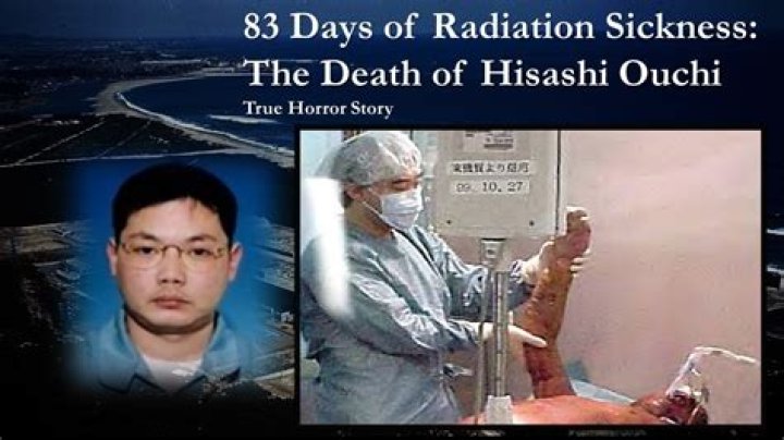 The Harrowing True Story Of Hisashi Ouchi: A Tragic Radiation Incident