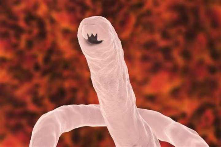 The Mysterious Death Of Tarrare, The Human Stomach