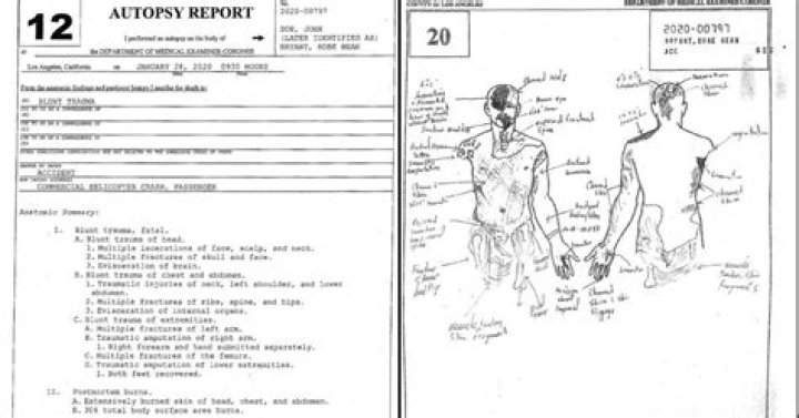 The Tragic Cause Behind Gianna Bryant's Death: Autopsy Report