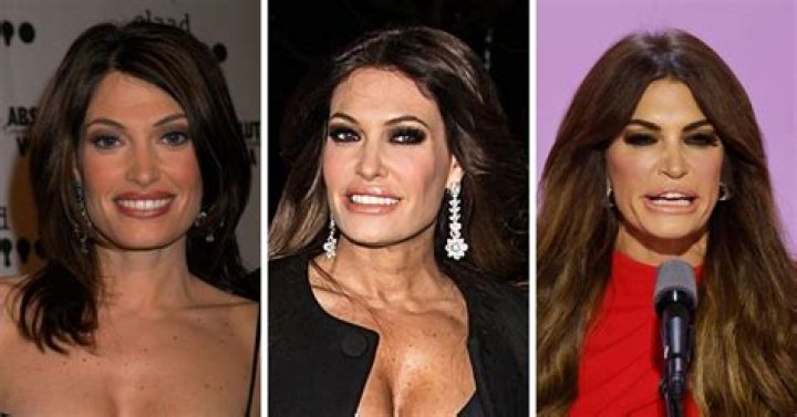 The Transformation Of Guilfoyle: A Before-and-After Journey