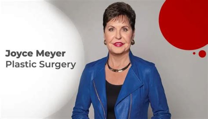 The Truth About Joyce Meyer's Face Surgery