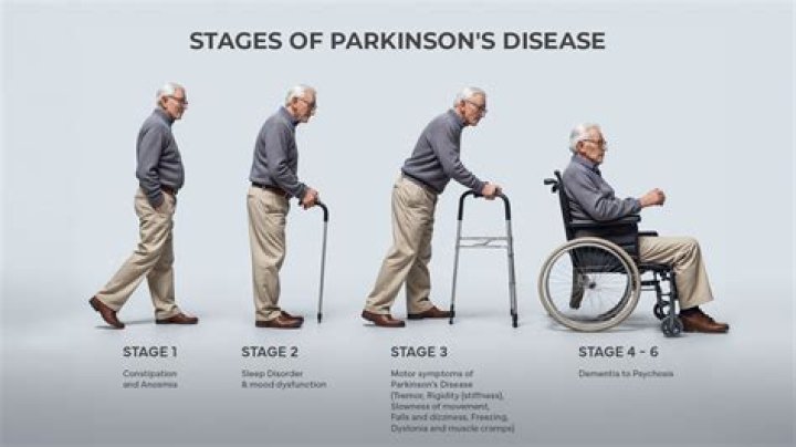 The Truth About Mark Levin's Health: Does He Have Parkinson's?
