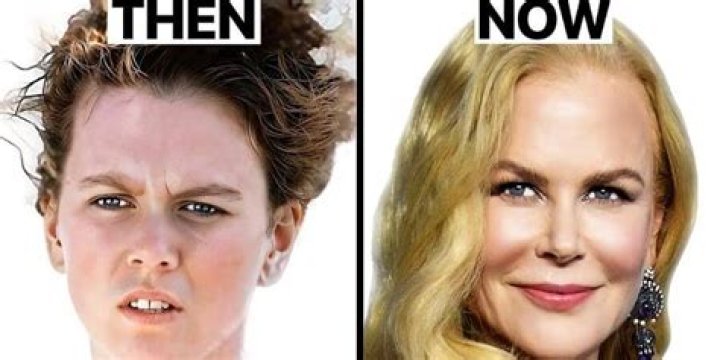 The Truth About Nicole Kidman's Breast Implants: Fact Or Fiction?