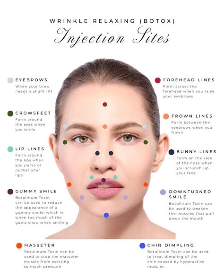 The Ultimate Guide To Garnacho Botox: Enhancing Your Beauty Safely