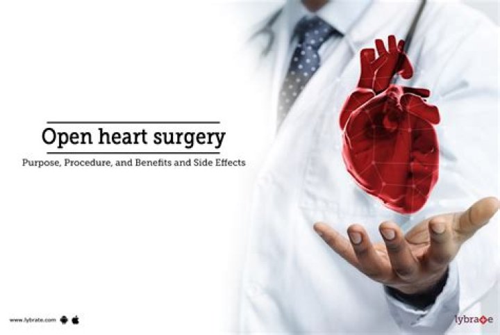 The Ultimate Guide To Open Heart Surgery Scar: Prevention, Treatment, And Management