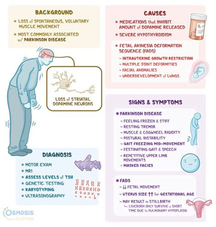 The Ultimate Guide To Sauce 90 Death: Causes, Symptoms, And Prevention