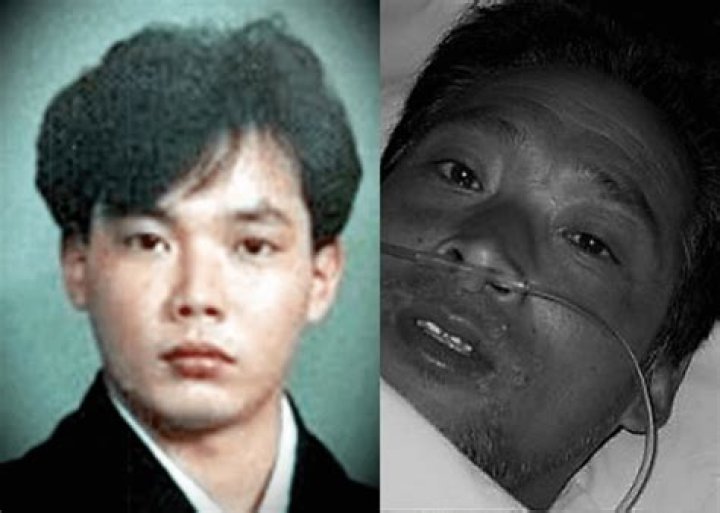 The Unseen Photo Of Hisashi Ouchi: A Rare Glimpse Of The Nagasaki Man's Ordeal