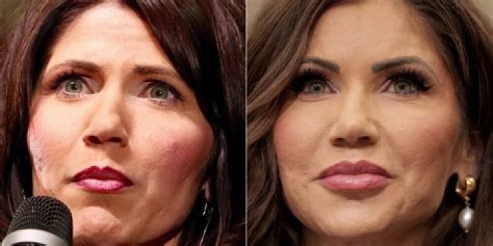 The Unseen Transformation: Kristi Noem's Pre-Plastic Surgery Appearance