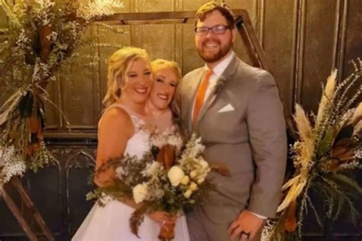 Tragic End: The Heartbreaking Loss Of The Hensel Twins In 2021