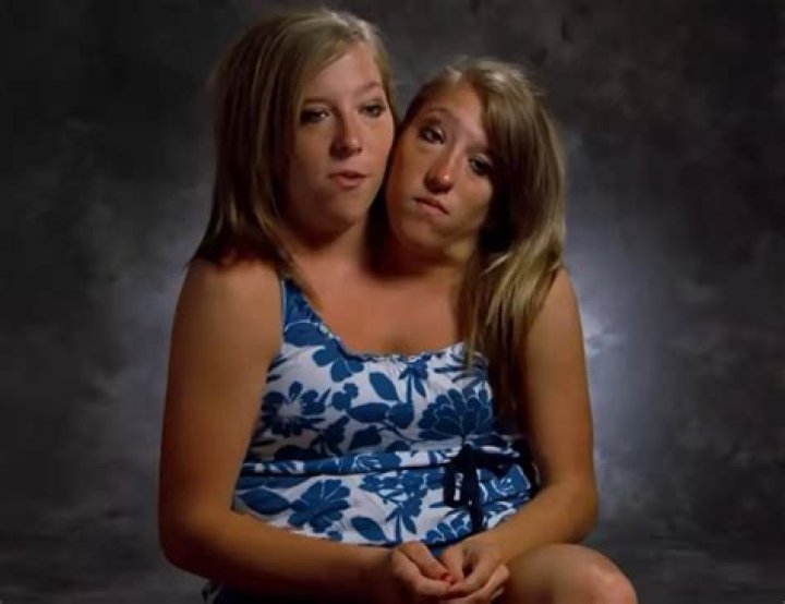 Twin Conjoined Twins Abby And Brittany Hensel Tragically Pass Away