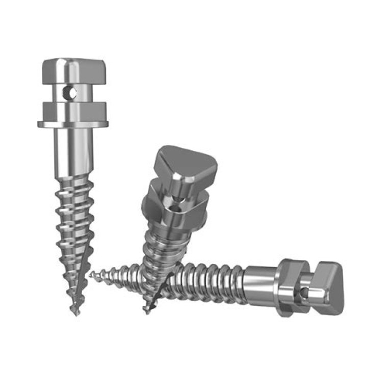 Ultimate Guide To The Tornillo Name: Etymology, Origin, And Variations