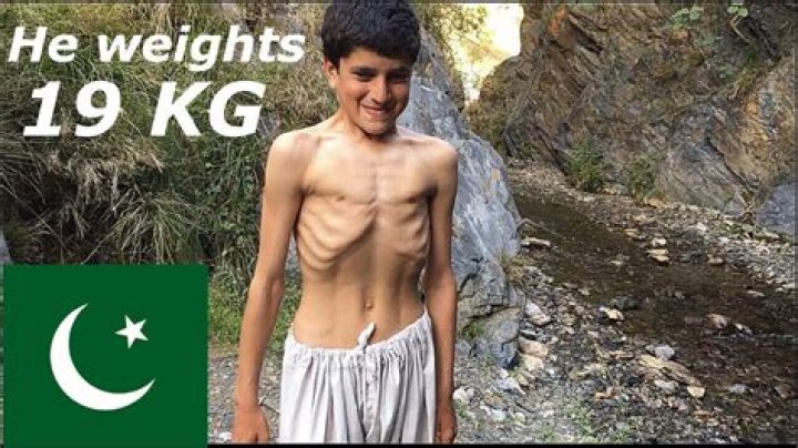 Uncover The Incredible Journey Of **The Slimmest Person In The World**