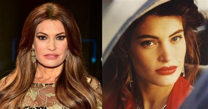 Uncover The Secrets Of Kimberly Guilfoyle's Plastic Surgery Journey