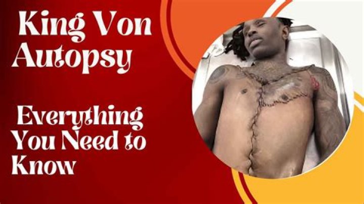Uncover The Tragic Details Of King Von's Autopsy