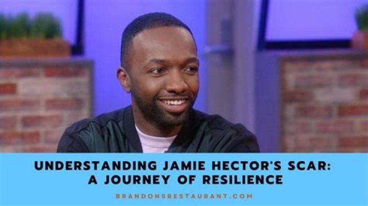 Uncovering The Origin Of Jamie Hector's Iconic Scar