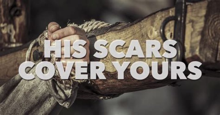 Uncovering The Scars Of His Past
