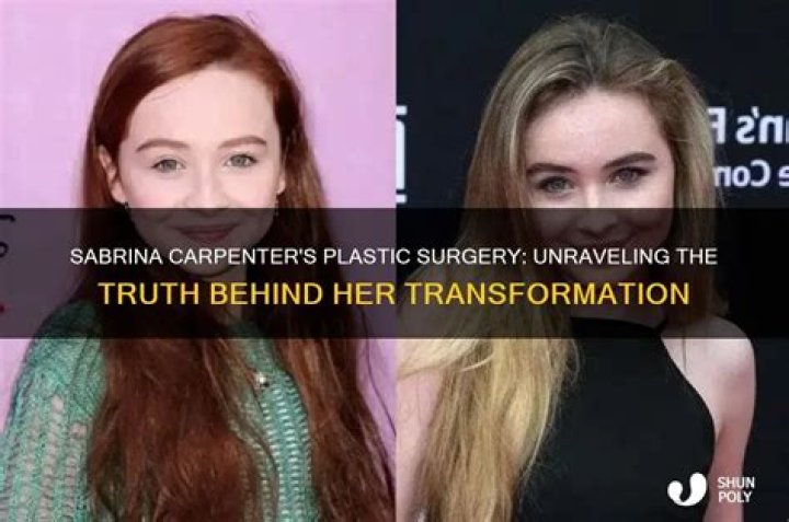 Uncovering The Truth: Did Sabrina Carpenter Get A Chin Implant?