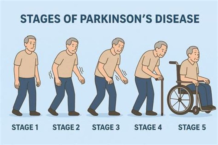 Understanding Chuck Todd's Parkinson's Disease Journey