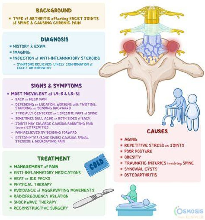 Understanding Hypertrophic Facet Disease: Causes, Symptoms, And Treatment