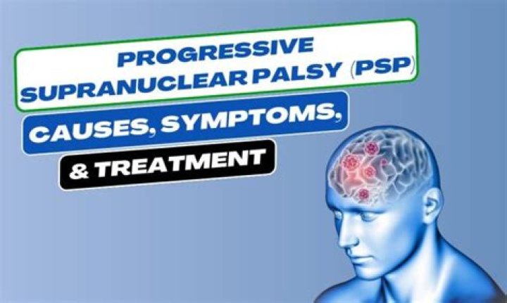Unraveling The Enigma Of Progressive Supranuclear Palsy
