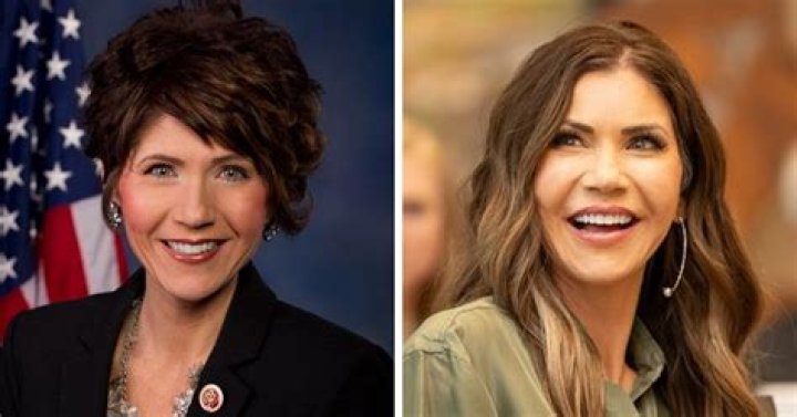 Unveiling Kristi Noem's Pre-Surgery Journey: Discoveries And Insights