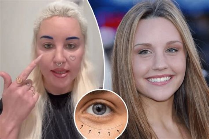 Unveiling Melanie Martinez's Plastic Surgery Journey: Insights And Discoveries