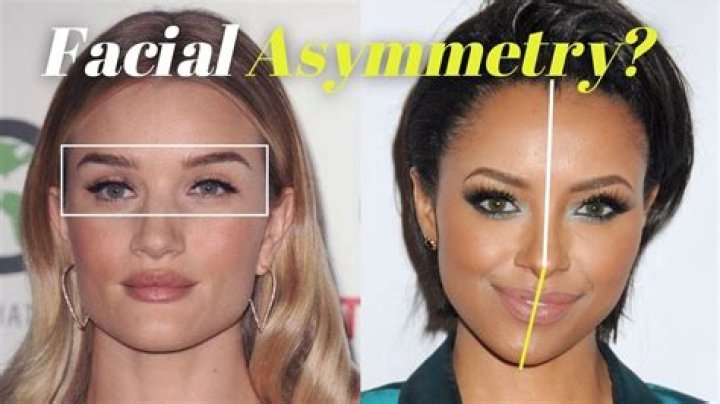 Unveiling The Beauty: Celebrities With Asymmetrical Faces