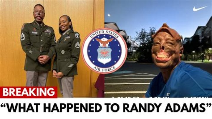 Unveiling The Impact Of Randy Adams' Face Accident: Insights And Revelations