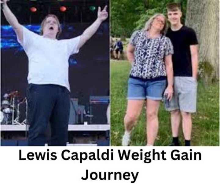 Unveiling The Intriguing Truths Behind Lewis Capaldi's Weight Gain