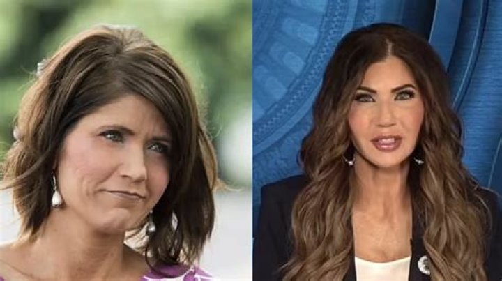 Unveiling The Journey: Kristi Noem's Alleged Plastic Surgery Transformation