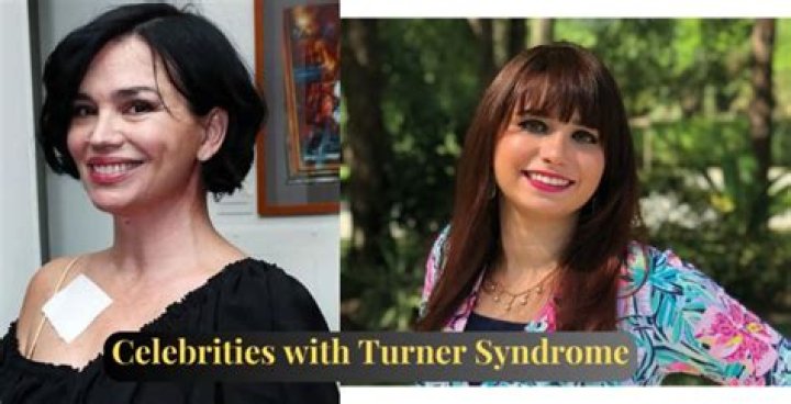 Unveiling The Remarkable Journeys Of Famous People With Turner Syndrome