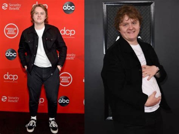 Why Did Lewis Capaldi Gain Weight: The Truth Behind His Transformation