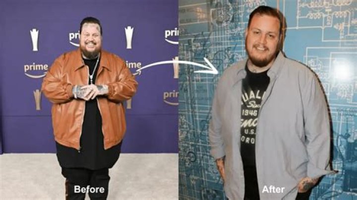 Zach Braff's Weight Transformation And Suspected Plastic Surgery